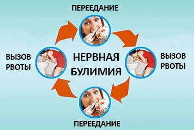 Лечение булимии в Маджалисе